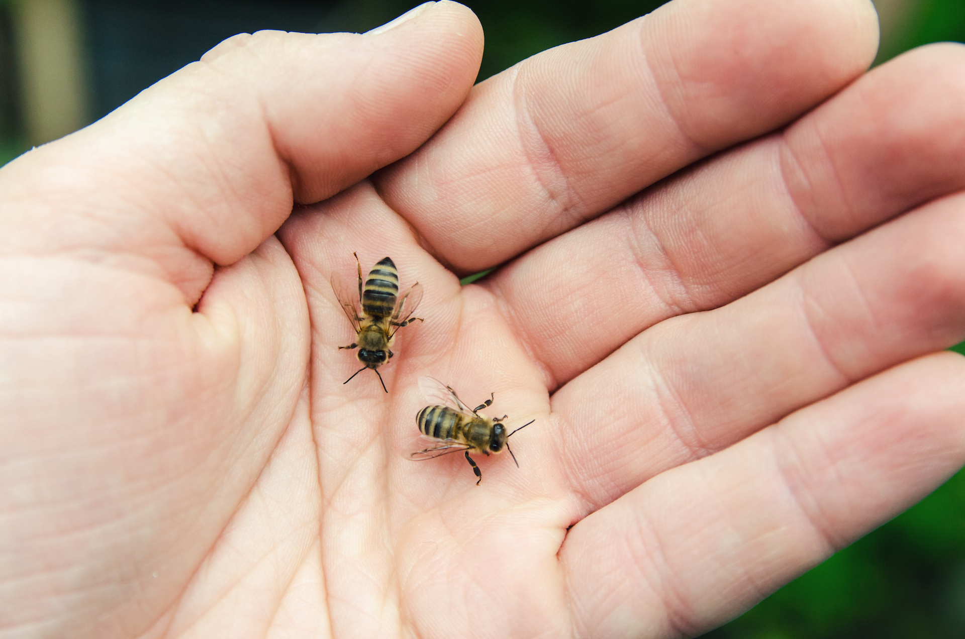 bee stinger removal